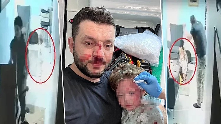 İkra ile babasının darbedilmesine ilişkin iddianame hazırlandı